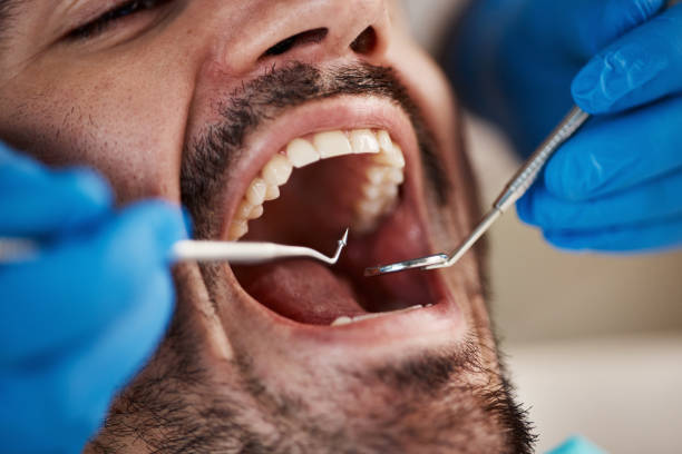 Laser Dentistry in Olmsted Falls, OH